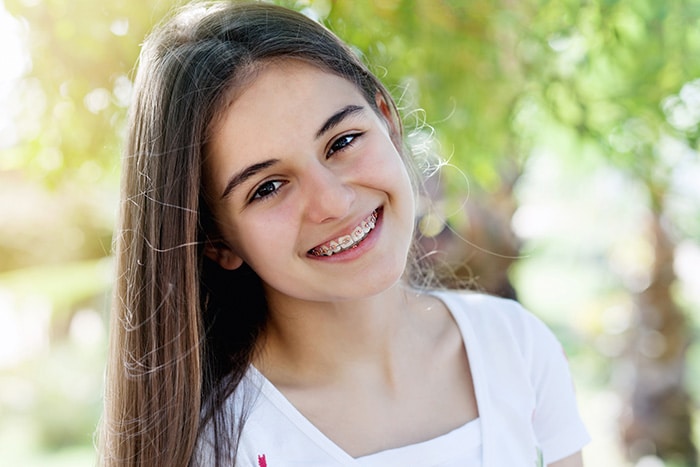 Types of braces at Highlands Ranch Orthodontics in Littleton, CO